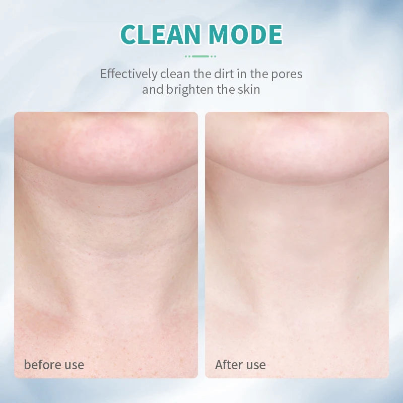 7 in 1 Light EMS Face Lifting Massager